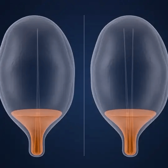 Two bladders filling: the younger one signals when it is full, the one after 60 signals when it is only half full